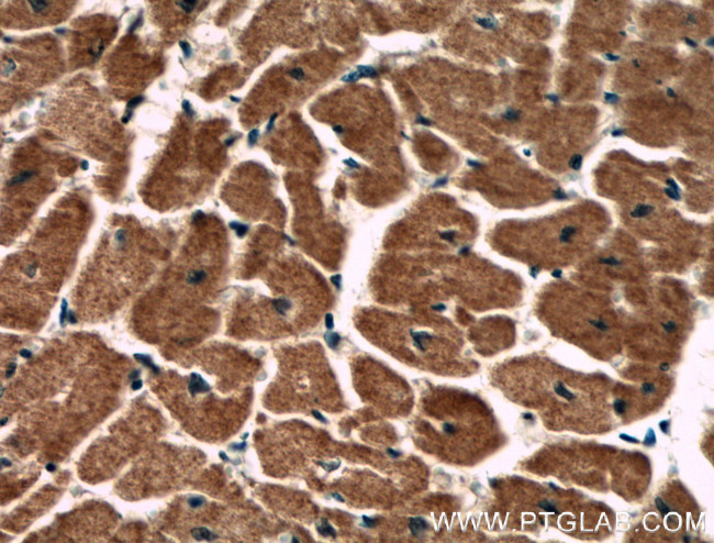 PCCB Antibody in Immunohistochemistry (Paraffin) (IHC (P))