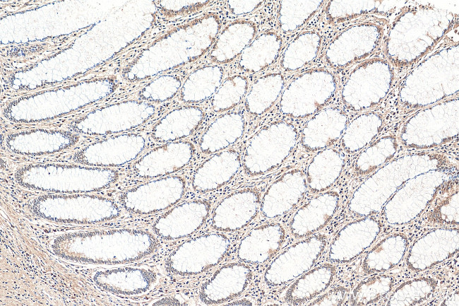 SMAD3 Antibody in Immunohistochemistry (Paraffin) (IHC (P))