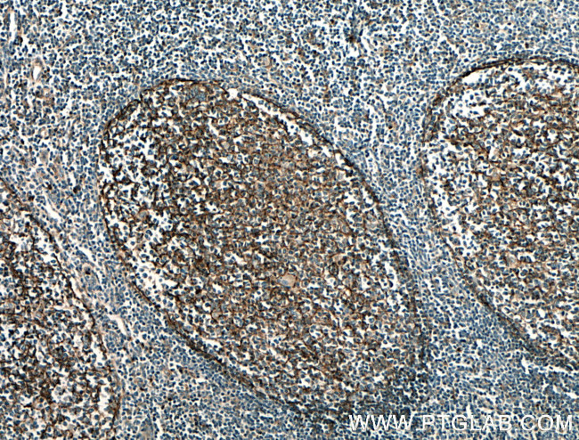 CD11B/Integrin alpha M Antibody in Immunohistochemistry (Paraffin) (IHC (P))