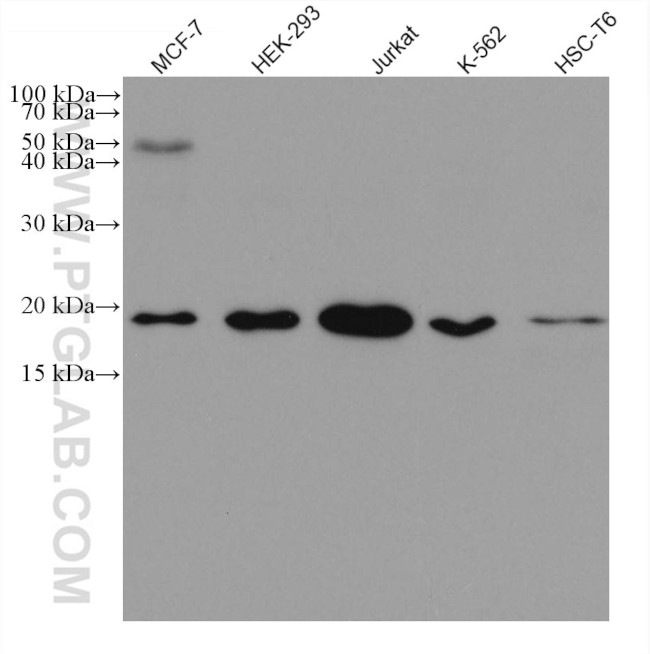 CGGBP1 Antibody in Western Blot (WB)