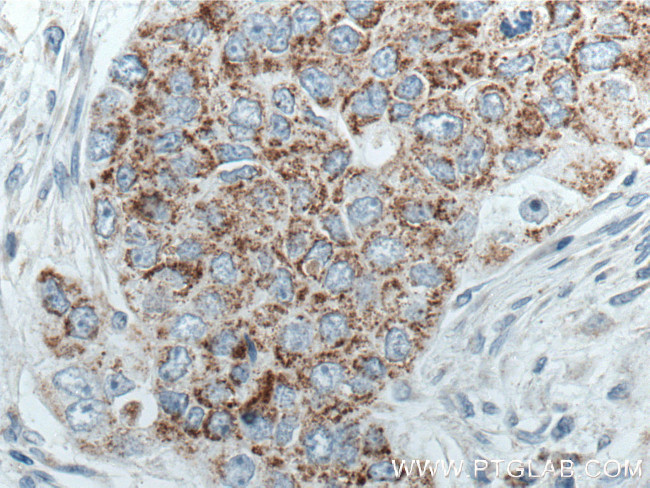 MRPL45 Antibody in Immunohistochemistry (Paraffin) (IHC (P))
