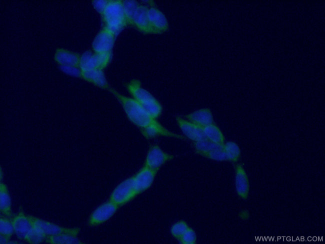 AP5Z1/SPG48 Antibody in Immunocytochemistry (ICC/IF)