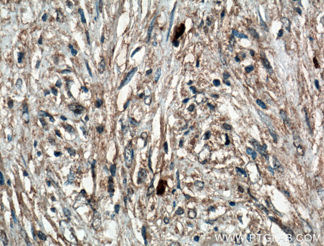 Calponin 1 Antibody in Immunohistochemistry (Paraffin) (IHC (P))