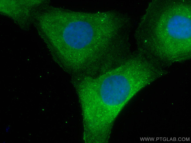 HE4 Antibody in Immunocytochemistry (ICC/IF)