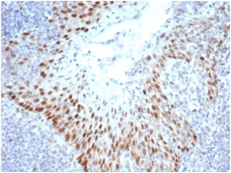SOX2 (Embryonic Stem Cell Marker) Antibody in Immunohistochemistry (Paraffin) (IHC (P))