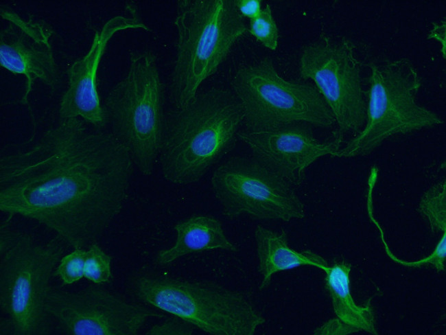 GTDC1 Antibody in Immunocytochemistry (ICC/IF)