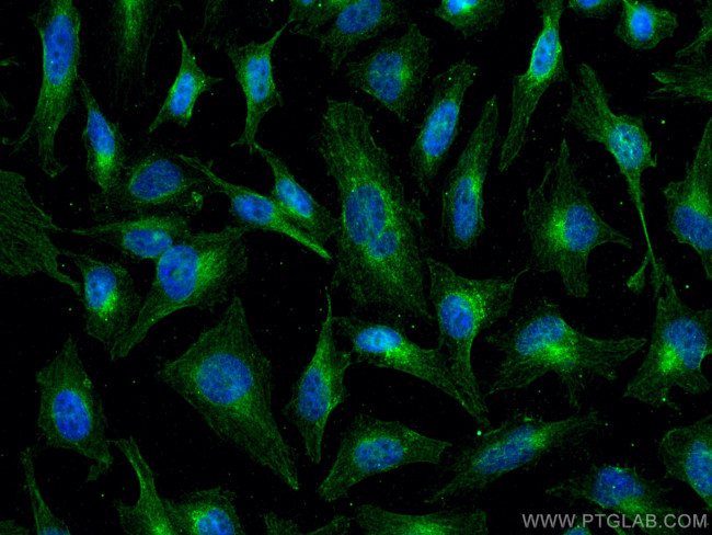 AMPK beta 2 Antibody in Immunocytochemistry (ICC/IF)