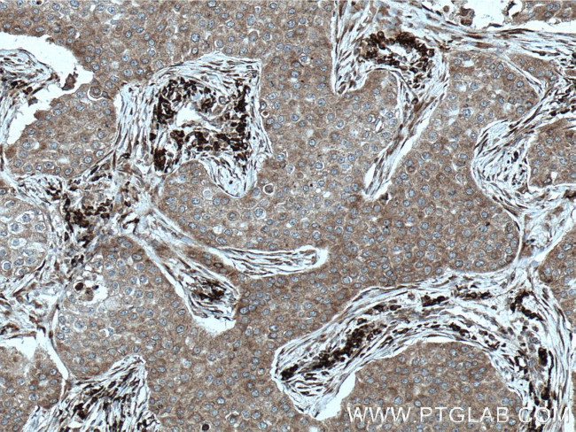 STT3A Antibody in Immunohistochemistry (Paraffin) (IHC (P))