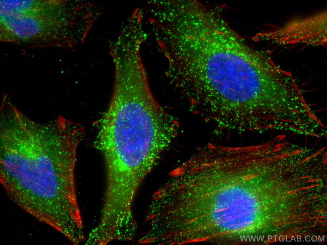 WBP2 Antibody in Immunocytochemistry (ICC/IF)