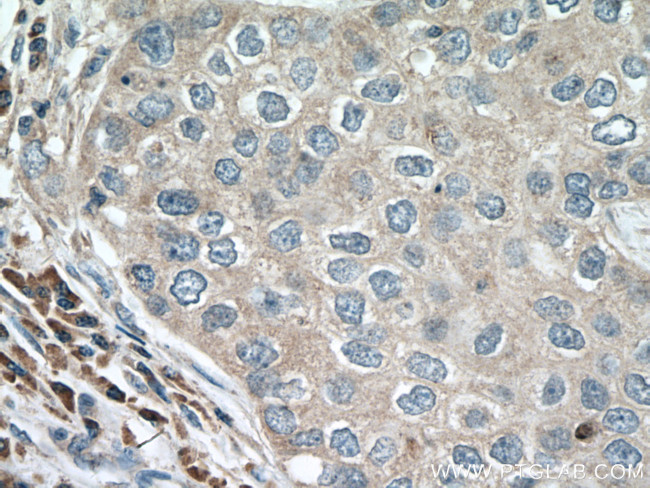 ACAP1 Antibody in Immunohistochemistry (Paraffin) (IHC (P))