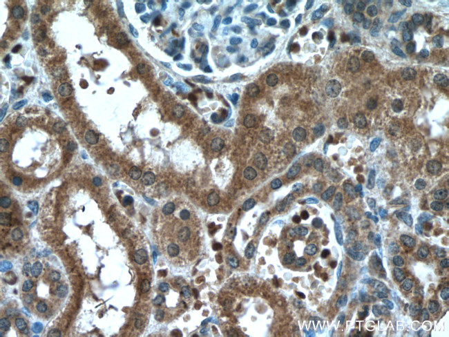 NXN Antibody in Immunohistochemistry (Paraffin) (IHC (P))