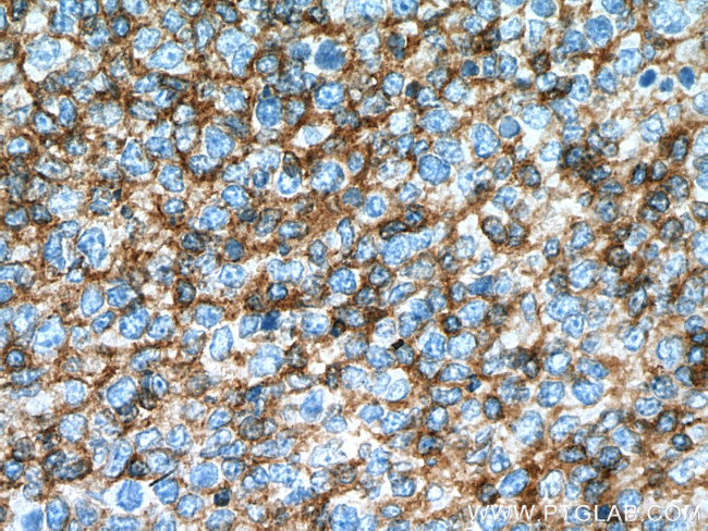 FYN Antibody in Immunohistochemistry (Paraffin) (IHC (P))