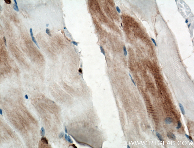 CA3 Antibody in Immunohistochemistry (Paraffin) (IHC (P))