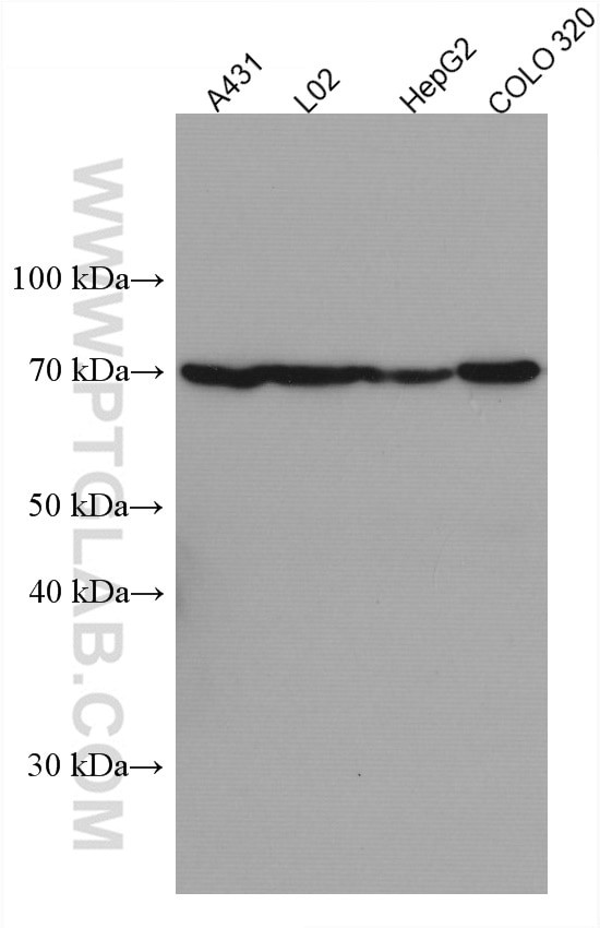 ND5 Antibody in Western Blot (WB)