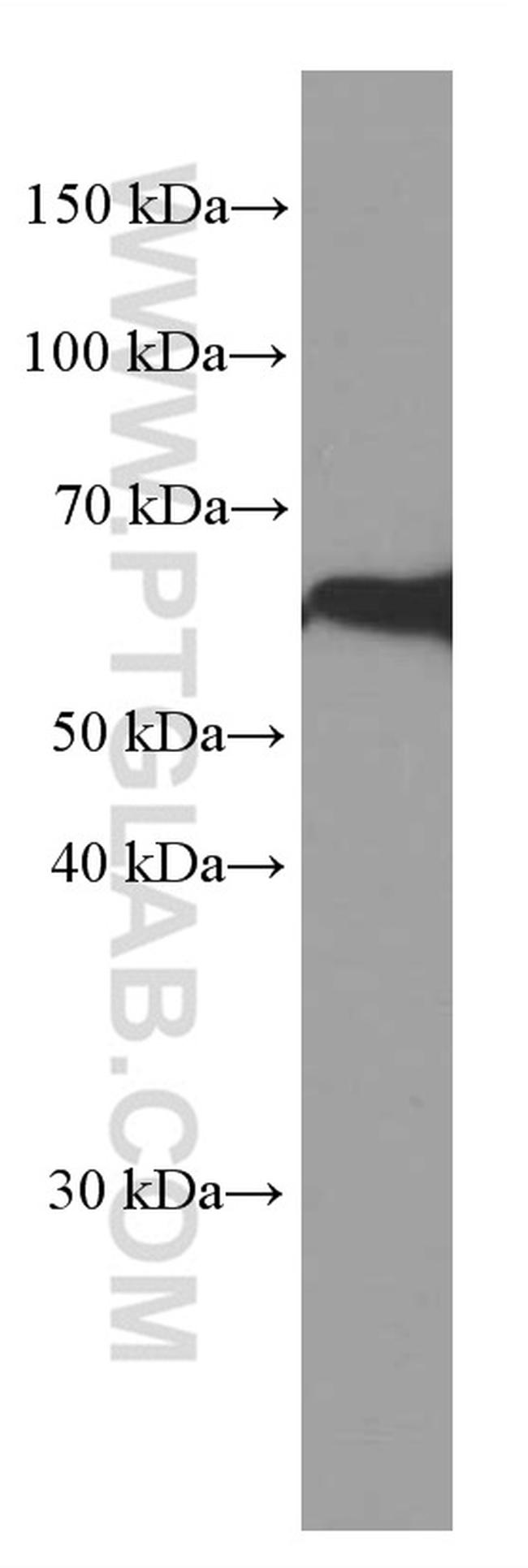 PPP3CB Antibody in Western Blot (WB)