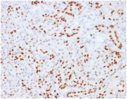 SOX9/SRY-box 9 Antibody in Immunohistochemistry (Paraffin) (IHC (P))