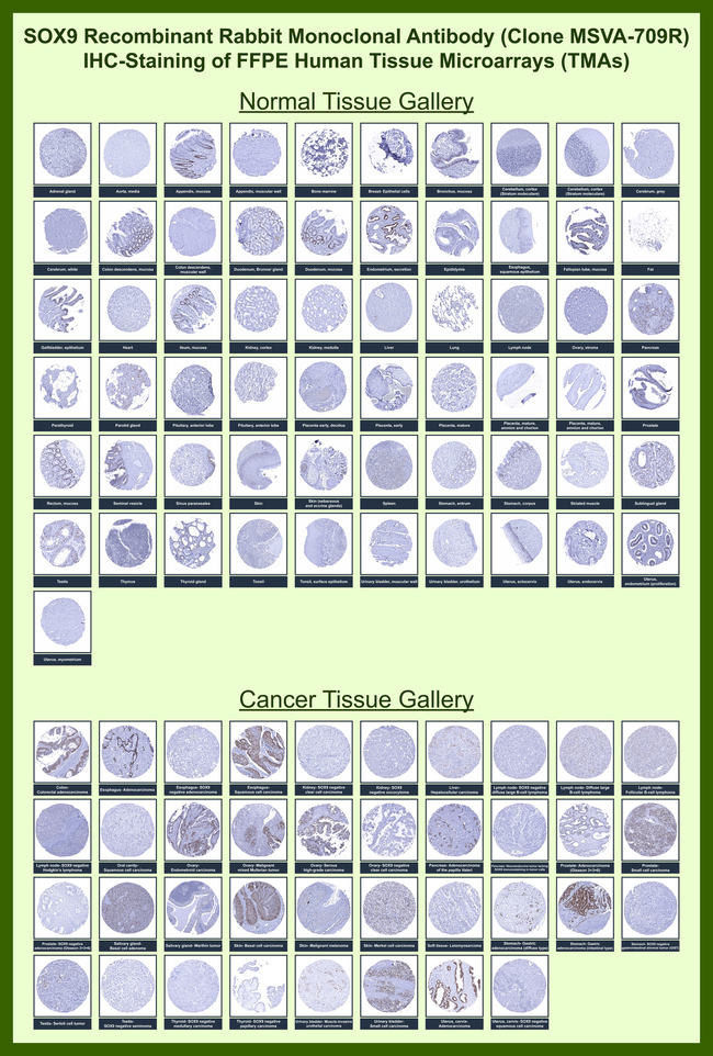 SOX9/SRY-box 9 Antibody in Immunohistochemistry (Paraffin) (IHC (P))