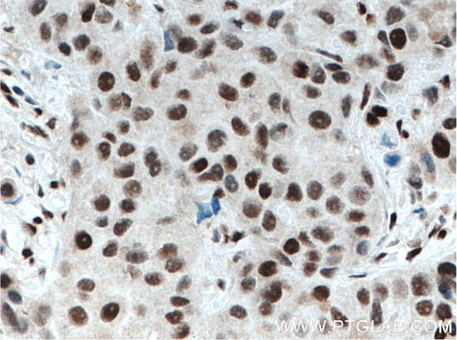 XRCC4 Antibody in Immunohistochemistry (Paraffin) (IHC (P))