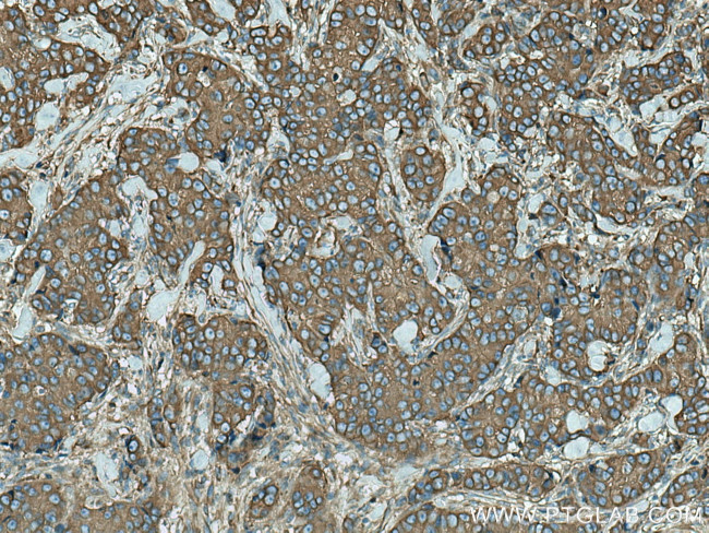 ACTN4 Antibody in Immunohistochemistry (Paraffin) (IHC (P))