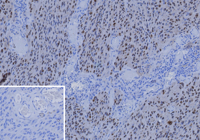 SOX10 (Melanoma Marker) Antibody in Immunohistochemistry (Paraffin) (IHC (P))