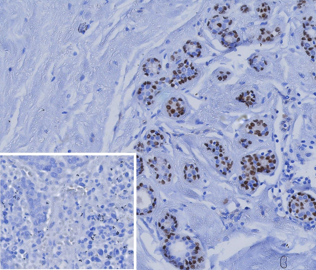 SOX10 (Melanoma Marker) Antibody in Immunohistochemistry (Paraffin) (IHC (P))