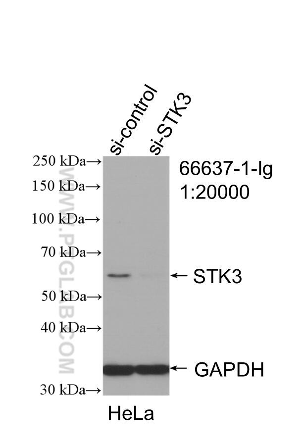 STK3 Antibody in Western Blot (WB)