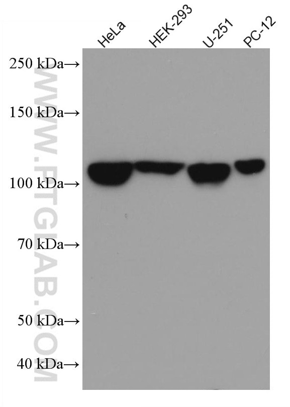 ANLN Antibody in Western Blot (WB)