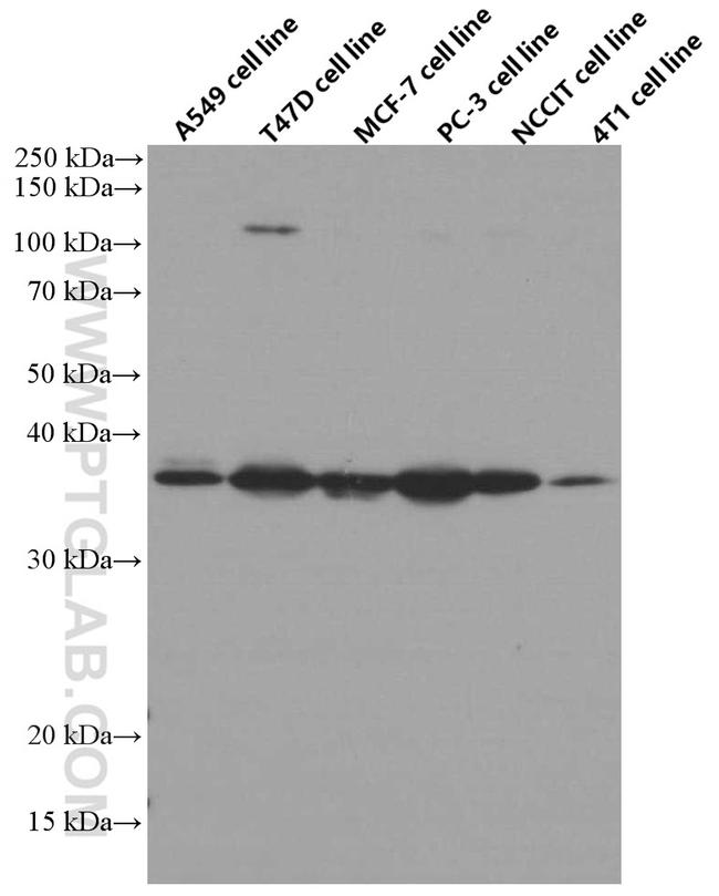 IGFBP2 Antibody in Western Blot (WB)