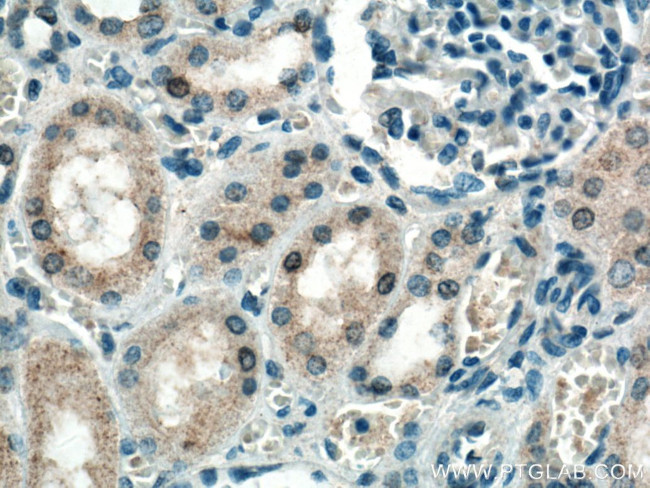EIF2AK2 Antibody in Immunohistochemistry (Paraffin) (IHC (P))