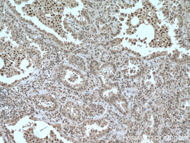 CEBPB Antibody in Immunohistochemistry (Paraffin) (IHC (P))