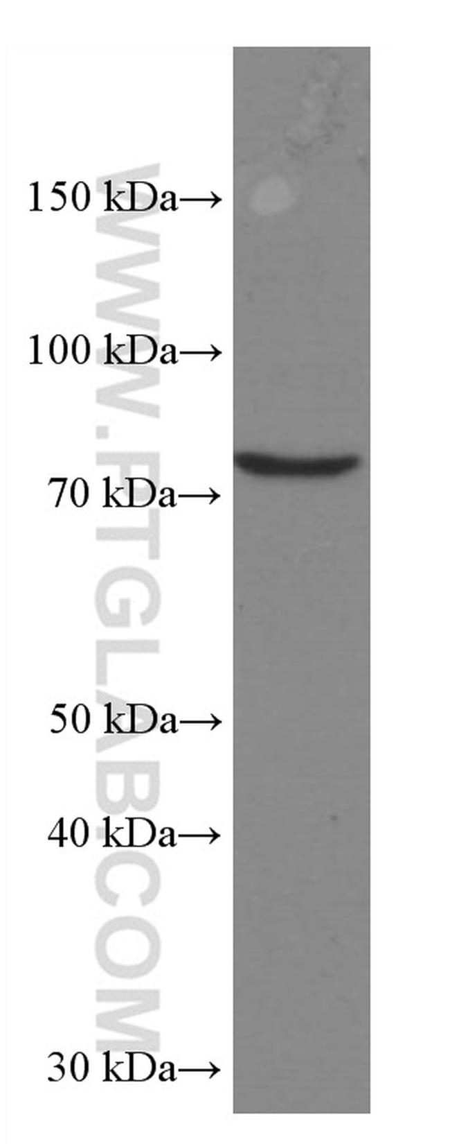 RASGRP3 Antibody in Western Blot (WB)