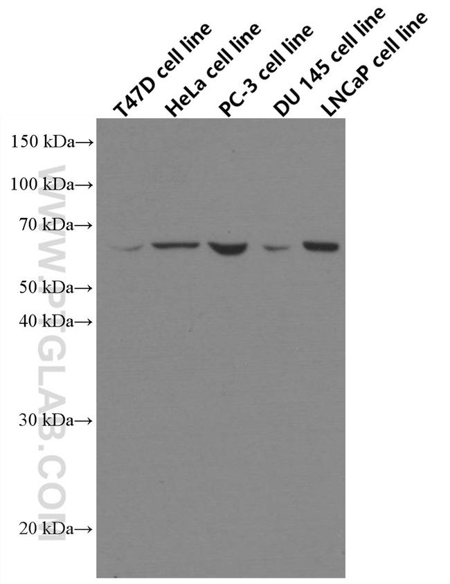 ETV5 Antibody in Western Blot (WB)