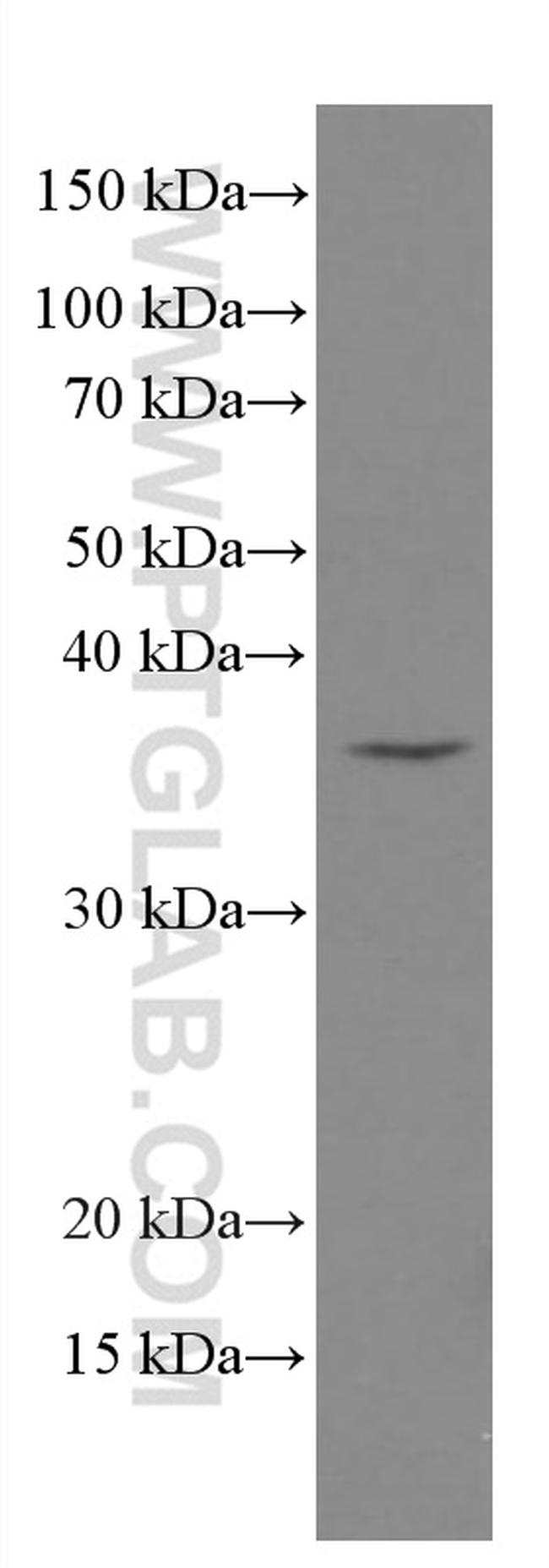 MYD88 Antibody in Western Blot (WB)