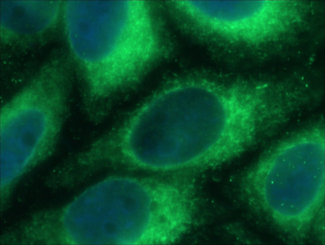PDIA6 Antibody in Immunocytochemistry (ICC/IF)