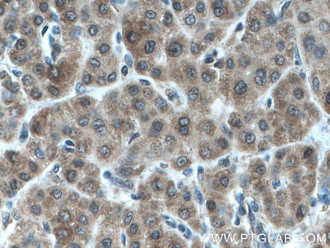 AKR7A2 Antibody in Immunohistochemistry (Paraffin) (IHC (P))