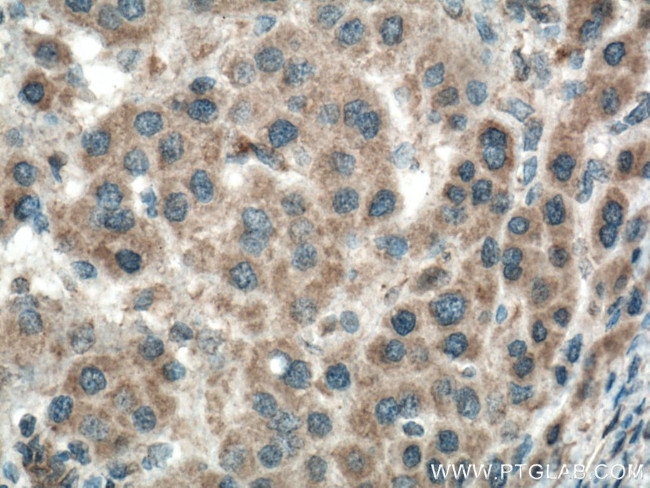 BBS10 Antibody in Immunohistochemistry (Paraffin) (IHC (P))