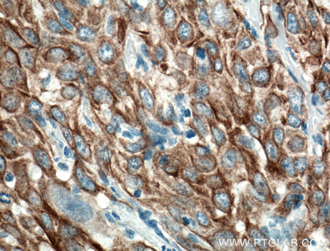 Cytokeratin 6A Antibody in Immunohistochemistry (Paraffin) (IHC (P))