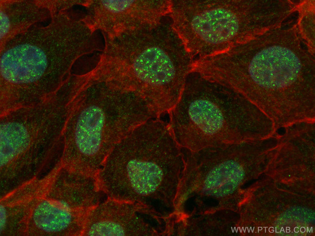 THRA Antibody in Immunocytochemistry (ICC/IF)
