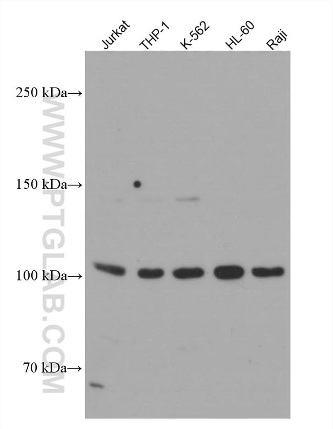 NOD2 Antibody in Western Blot (WB)