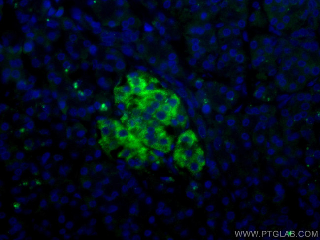 RHEB Antibody in Immunohistochemistry (PFA fixed) (IHC (PFA))