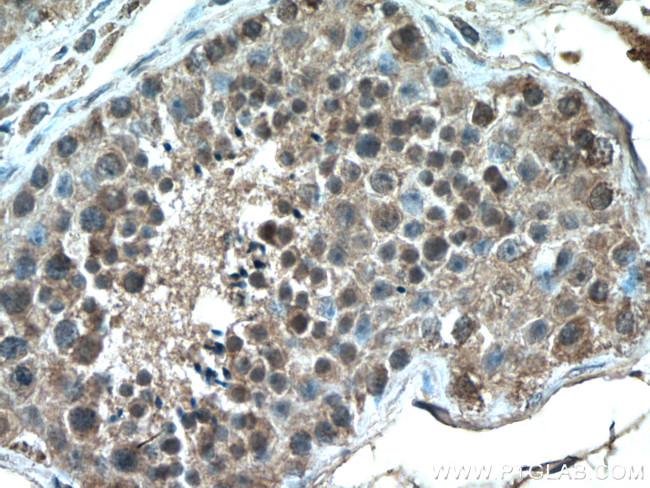 CHCHD4 Antibody in Immunohistochemistry (Paraffin) (IHC (P))