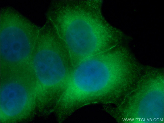 HSPH1 Antibody in Immunocytochemistry (ICC/IF)