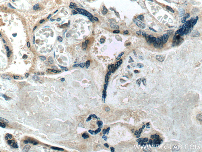 Placental lactogen Antibody in Immunohistochemistry (Paraffin) (IHC (P))