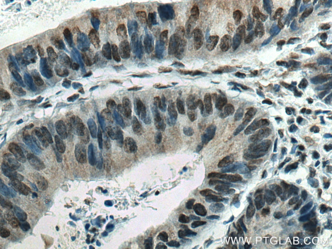 EPAS1 Antibody in Immunohistochemistry (Paraffin) (IHC (P))