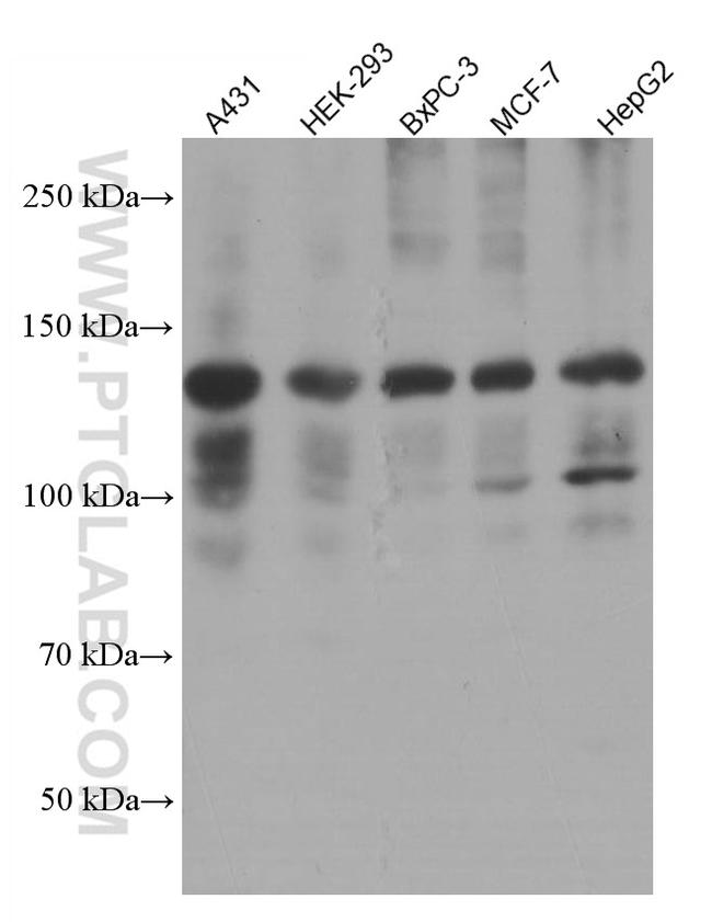 EPHA2 Antibody in Western Blot (WB)