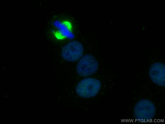 SRF Antibody in Immunocytochemistry (ICC/IF)