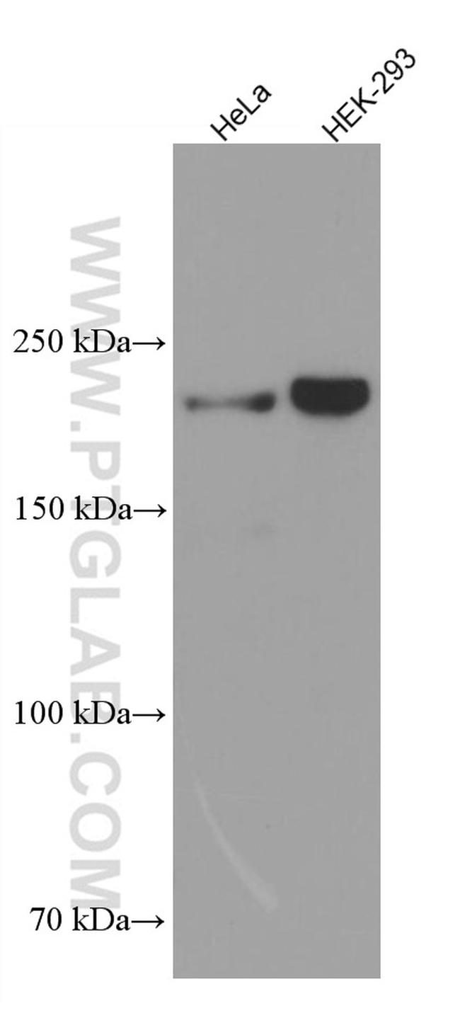 KIAA0284 Antibody in Western Blot (WB)