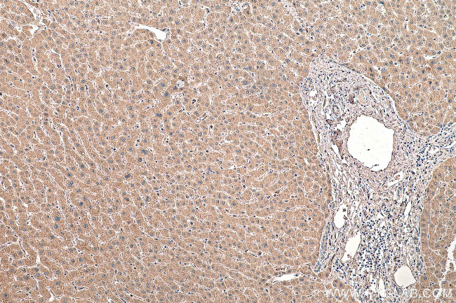Factor X Antibody in Immunohistochemistry (Paraffin) (IHC (P))