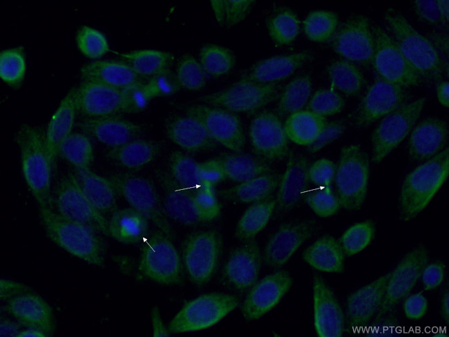 AURKA Antibody in Immunocytochemistry (ICC/IF)