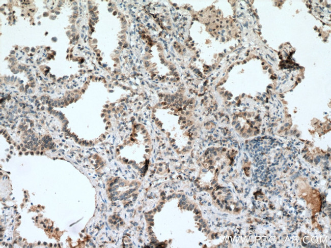 BACH1 Antibody in Immunohistochemistry (Paraffin) (IHC (P))